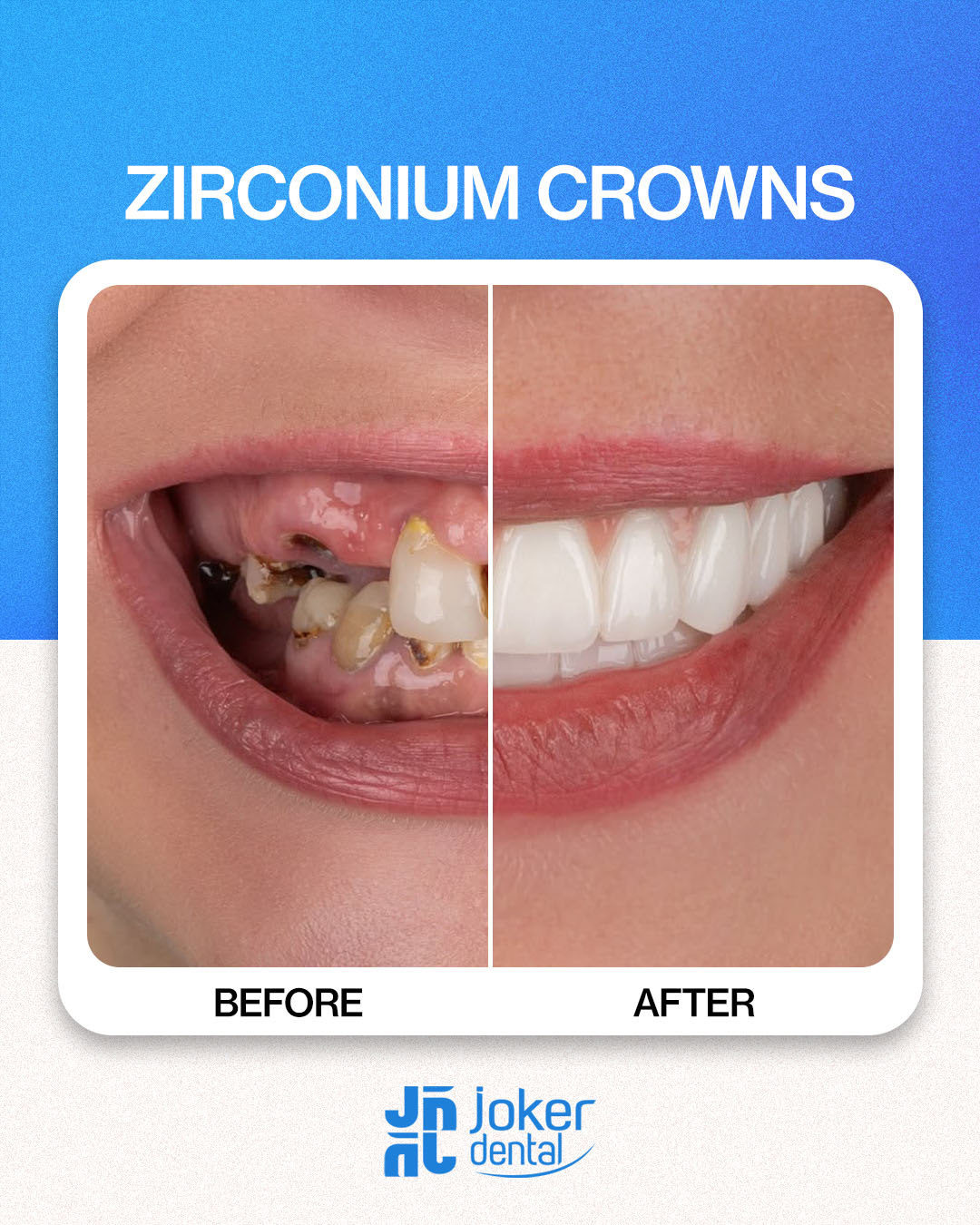 İsdentbul Before After 2
