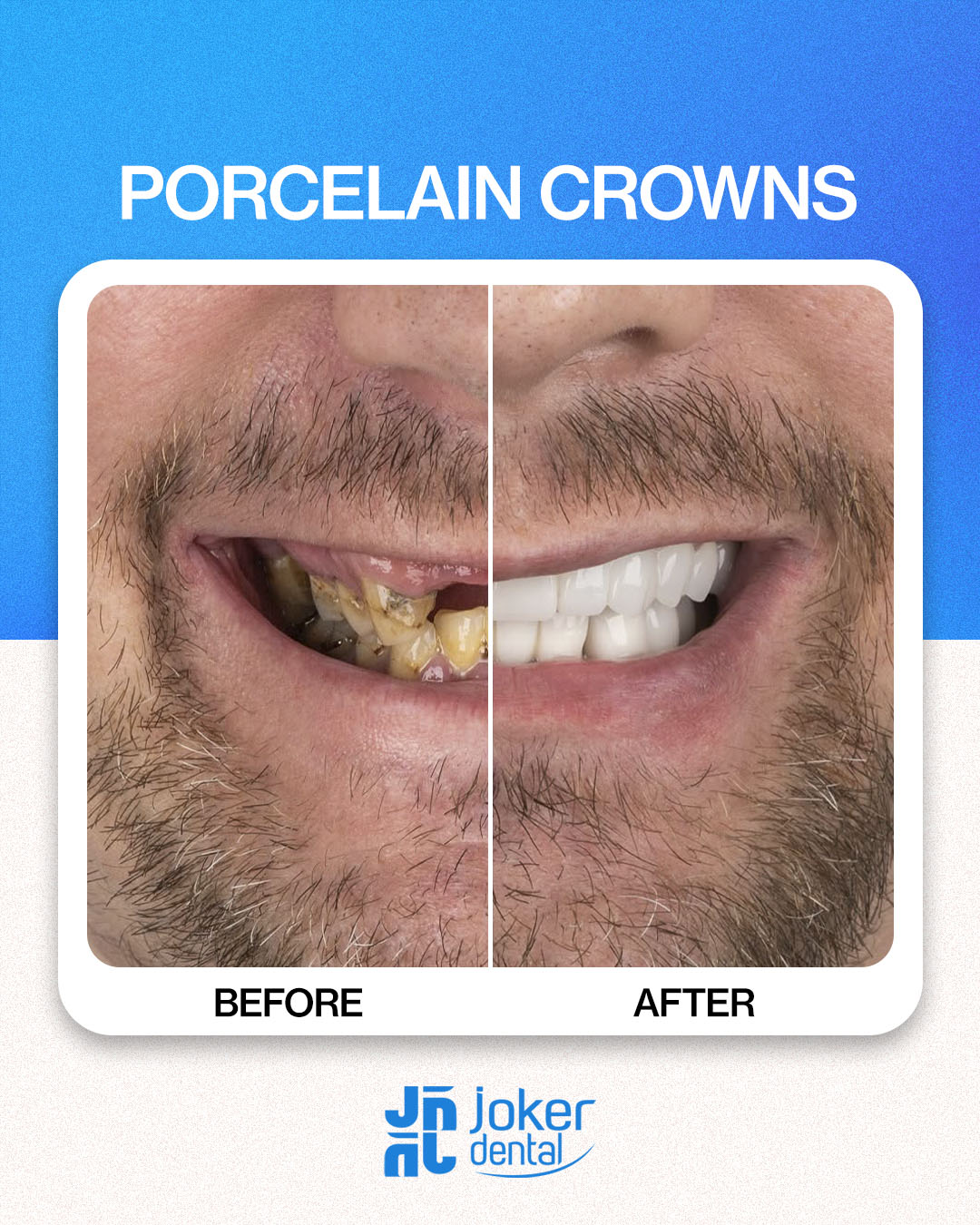 İsdentbul Before After 5